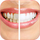 Home Remedies for Receding Gum. APK