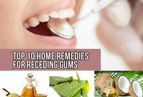 Home Remedies for Receding Gum. Ekran Görüntüsü 1