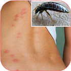 Home Remedies for Insect Bites Zeichen