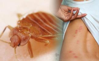 Home Remedies for Insect Bites Plakat
