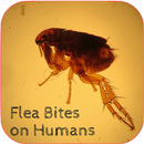 Signs of Flea Bites. APK