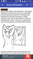 Breast Cancer постер
