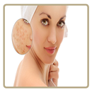 Acne & Pimples (Home Care) APK