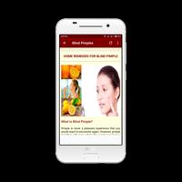Acne & Pimples (Home Care) تصوير الشاشة 2