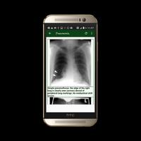 Radiological Emergencies تصوير الشاشة 1