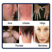 All Skin Disorders