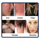 All Skin Disorders APK