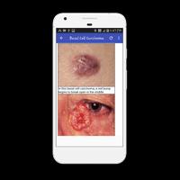 All Skin Disorders Ekran Görüntüsü 3