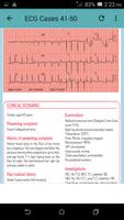 ECG Cases تصوير الشاشة 1