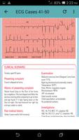 ECG Cases Screenshot 1