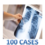 100 Cases In Radiology أيقونة