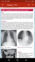 100 Cases In Radiology capture d'écran 1