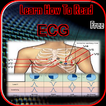 Basic ECG Guide