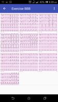 Basic ECG Guide capture d'écran 3