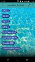 Basic ECG Guide Poster