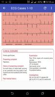 Basic ECG Guide captura de pantalla 1