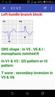 Basic ECG Guide captura de pantalla 2