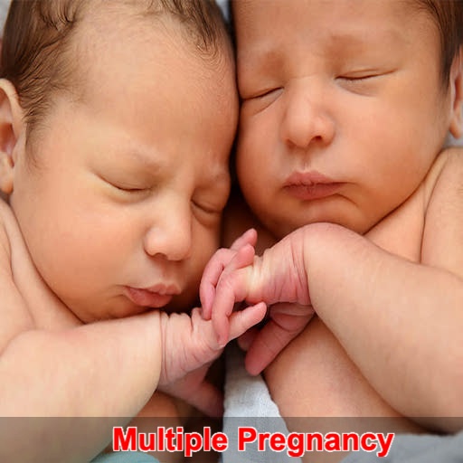 Multiple Pregnancy