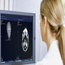 CT Brain APK