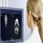 CT Brain Zeichen