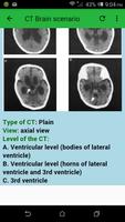 CT Brain Screenshot 3