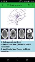 CT Brain Screenshot 1