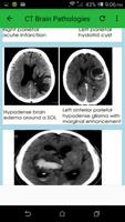 CT Brain Screenshot 2