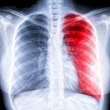 Chest X-ray Easy Guide icon