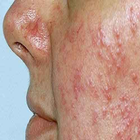 100 Cases In Dermatology иконка