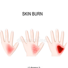 آیکون‌ Skin Burns
