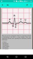 Heart Murmurs 截图 3