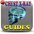 Chest X-ray Made Easy APK