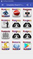 Poster Chest X-ray Made Easy