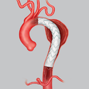 Open Vascular Surgery Skills APK