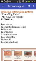 Dermatology Mnemonics (Free). imagem de tela 3