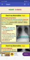 All Lung Sounds & Chest X-Rays capture d'écran 2