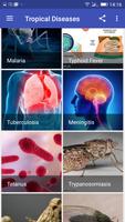 Tropical Diseases-poster