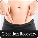 C-Section Recovery APK