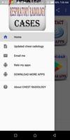 Updated Cases Of Chest Radiology screenshot 2