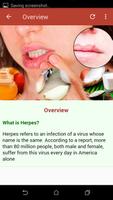 Herpes Solution capture d'écran 1