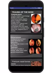 Illustrated ENT Handbook APK download