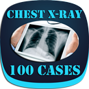 Interpret Chest X-Ray With 100 Cases APK