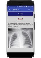 Interpret Chest X-Ray With 100 Cases imagem de tela 3