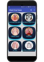 Interpret Chest X-Ray With 100 Cases Cartaz