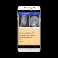 Learn Abdominal Radiological Findings Screenshot 1