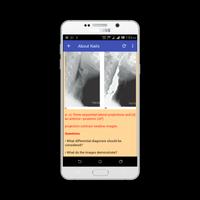 Learn Abdominal Radiological Findings Screenshot 2