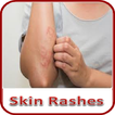 Skin Rashes