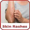 Skin Rashes APK