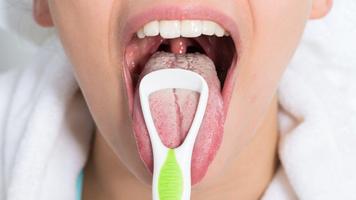 Consejos Caseros para Quitar el Mal Aliento Ekran Görüntüsü 2