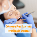 Cómo se Realiza una Profilaxis Dental APK